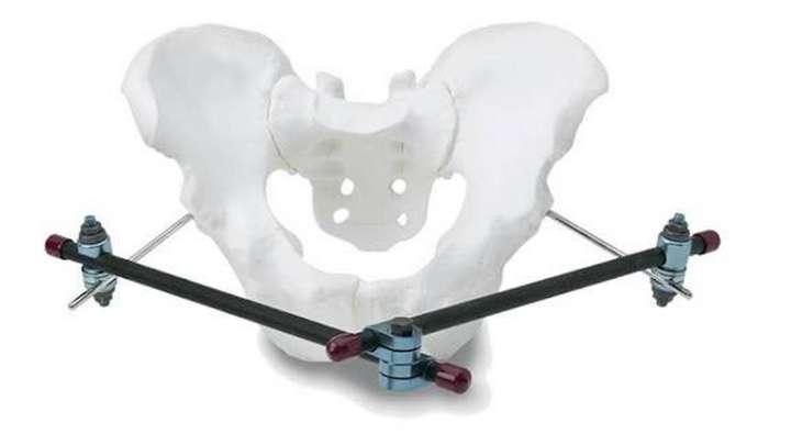 Воронежские врачи спасли серьёзно пострадавшую после падения с тюбинга 41-летнюю пациентку