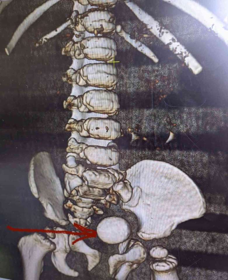 yg9W4Arcig8.jpg yg9W4Arcig8.jpg