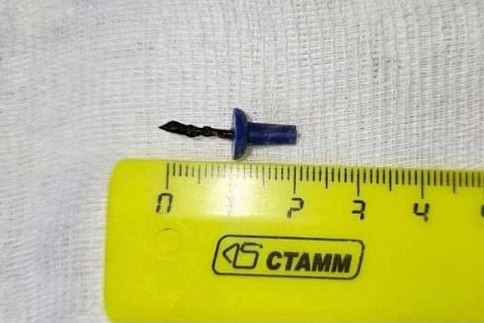 В Воронеже девочка, боясь рассказать родителям, год ходила с канцелярской кнопкой в лёгких