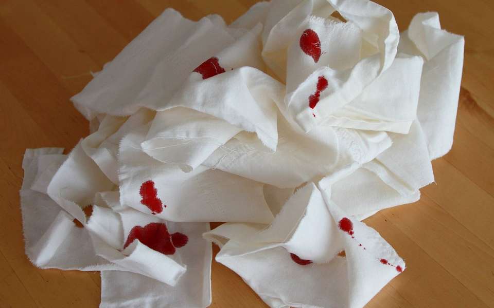 Химический ожог конечностей получил работник маслозавода в Воронежской области