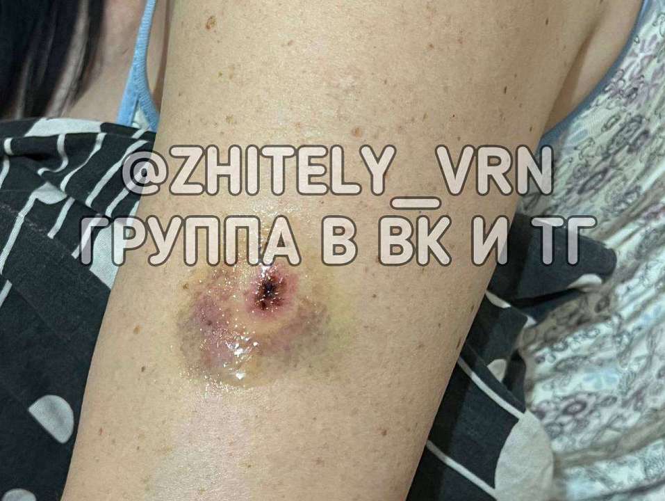 В воронежском супермаркете воровка покусала продавца и вынесла пакет продуктов