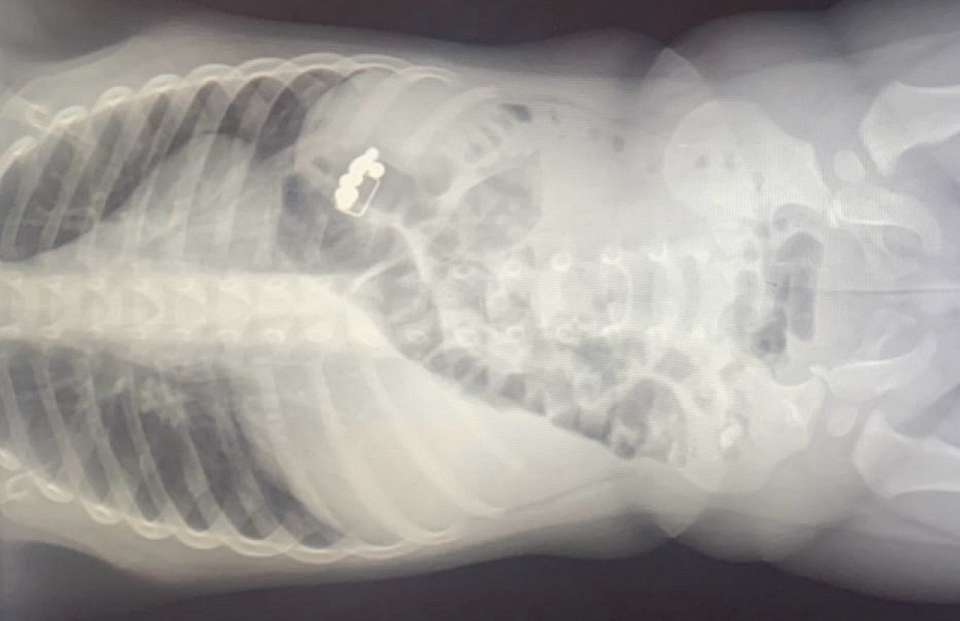 Магниты и скрепку достали из желудка 2-летнего ребёнка воронежские врачи