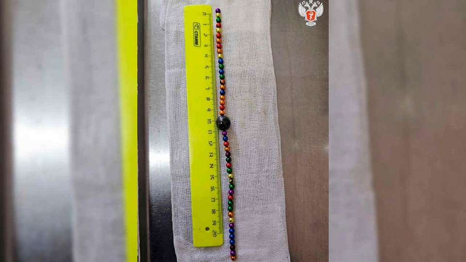 Двухлетний мальчик в Воронеже проглотил 48 магнитов