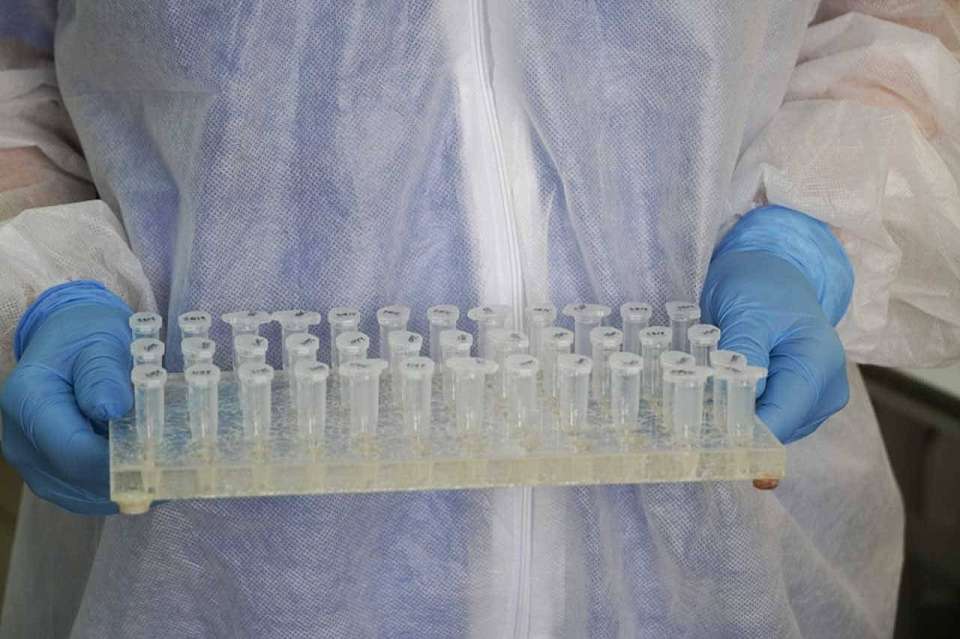 Случаи заражения метапневмовирусом отмечаются в Воронежской области