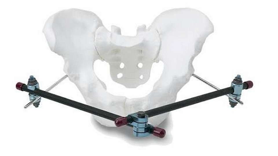 Воронежские врачи спасли серьёзно пострадавшую после падения с тюбинга 41-летнюю пациентку