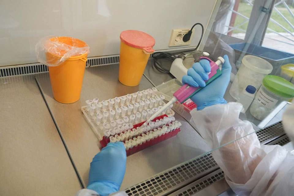 ВИЧ-инфекцию выявили в 2024 году у 424 воронежцев